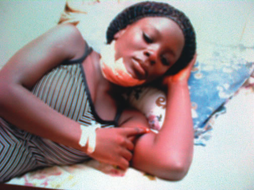 WTF: [Photo] Lagos State Councillor Stabs 18 Year Old Girl In The Neck For Refusing His Love Advances