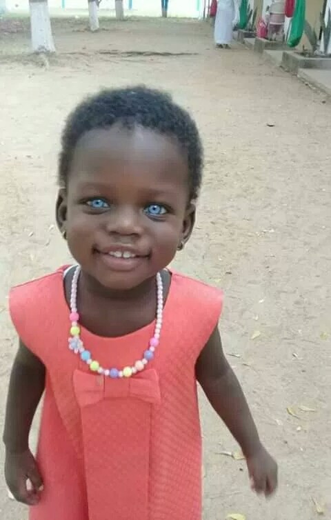 2-Year-Old Ghanaian Girl With Blue Eyes Accused Of Witchcraft (photos)