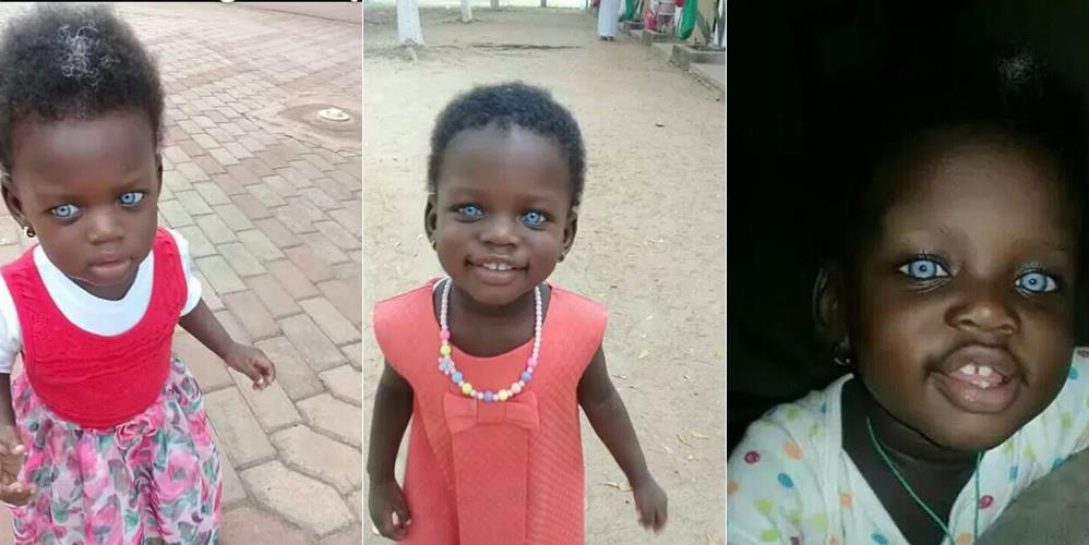 2-Year-Old Ghanaian Girl With Blue Eyes Accused Of Witchcraft (photos)