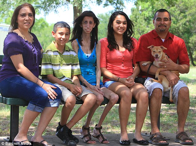 PHOTOS: The Girl Who Must Eat Every 15 Minutes To Stay Alive