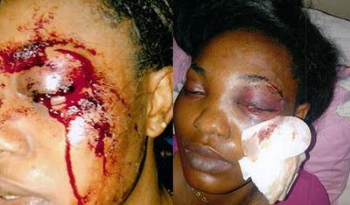 Man Stabs Wife In The Eyes, Blinds Her