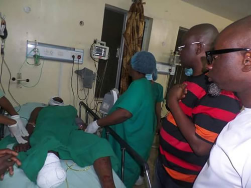 Ekiti crash: EKSU student's leg amputated