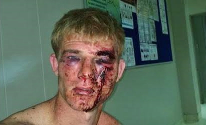 See the Whiteman Beaten to a Pulp in Lagos for Trying to Hook Up with Facebook Friend for Gay S*x (Photo)