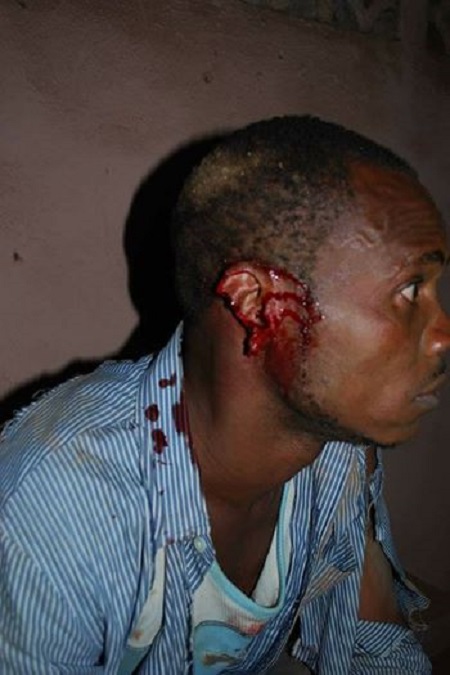 Drama as Man's Ear is Chopped Off While Separating a Fight at a Birthday Party in Abia State (Photos)