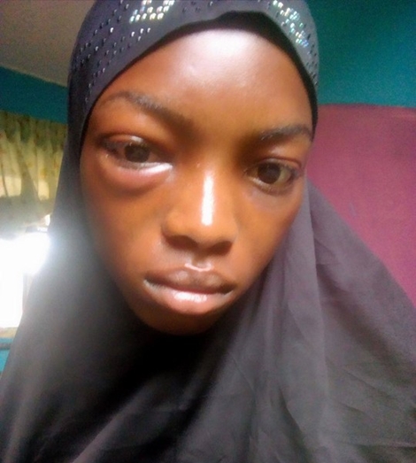 Final Year Female University Student Allegedly Brutalized for Not Agreeing to Date a Guy (Photos)