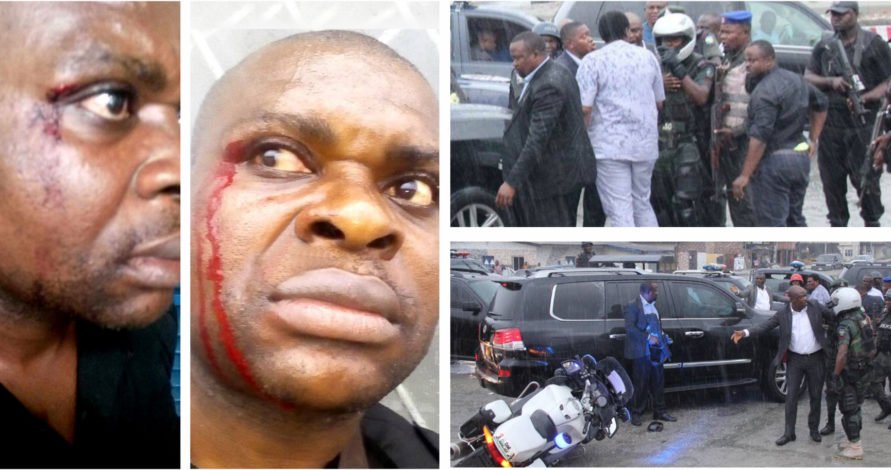 Amaechi's Police Escort Battered After Clashing with Governor Wike's Security Aides (Photo)