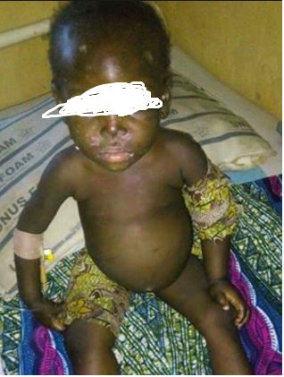 Graphic: See the 2-year-old Girl Who Was R*ped and Brutalized By Her Own Father in Kaduna (Photos)