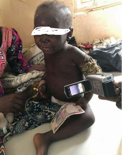 Graphic: See the 2-year-old Girl Who Was R*ped and Brutalized By Her Own Father in Kaduna (Photos)