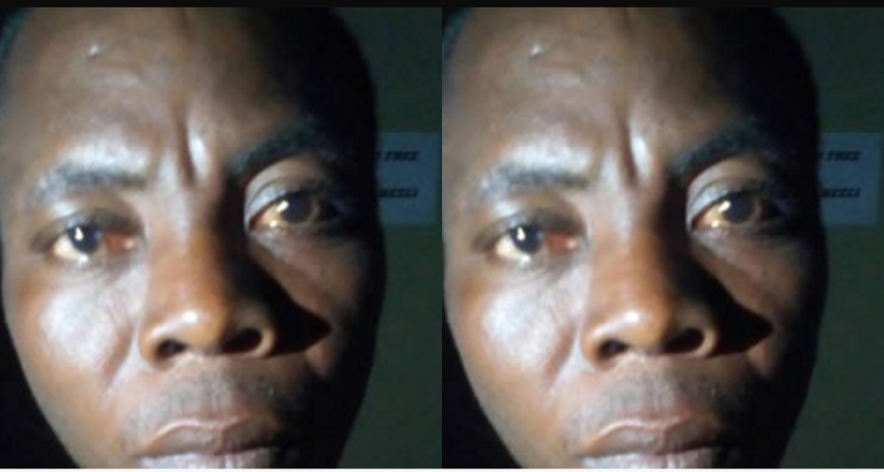 See the Face of Man Who Used Juju to Kill His Neighbour During a Fight (Photo)