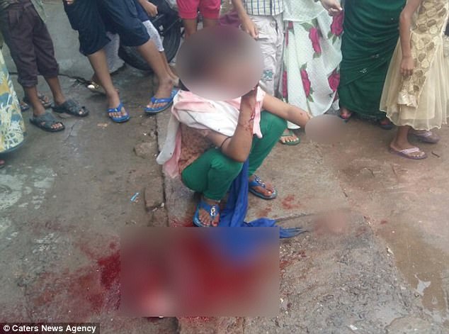 Jilted Lover Chops Off Teenage Girl's Hand For Refusing to Go Out With Him (Graphic Photos)