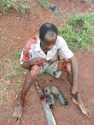 Fulani Herdsmen Allegedly Attack Farmer in Enugu, Chop Off His Fingers (Graphic Photos)