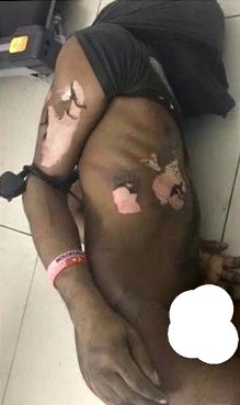 Tortured In Malaysia 3