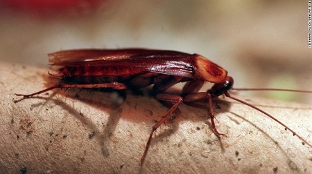 Unbelievable! Doctors Pull Out a Live Cockroach from a Woman's Skull (Watch Video)
