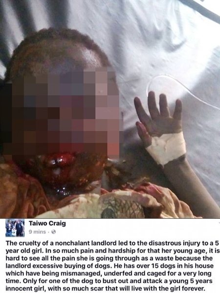 Oh No! 5-year-old Girl Brutally Attacked by One of Landlord's 15 Dogs, Dies in Lagos Hospital