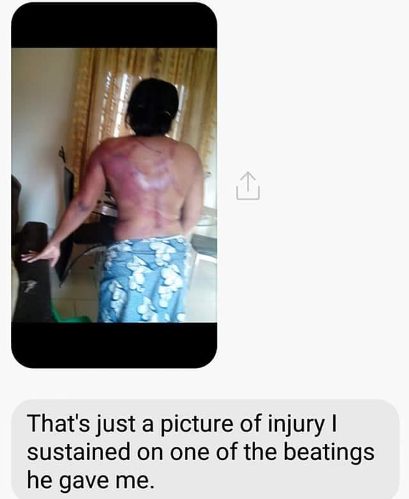 So Sad! See What Nigerian Man Did to His Wife During a Disagreement (Photo)