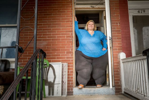 Meet The Woman Risking Her Life To Have The World's Biggest Hips