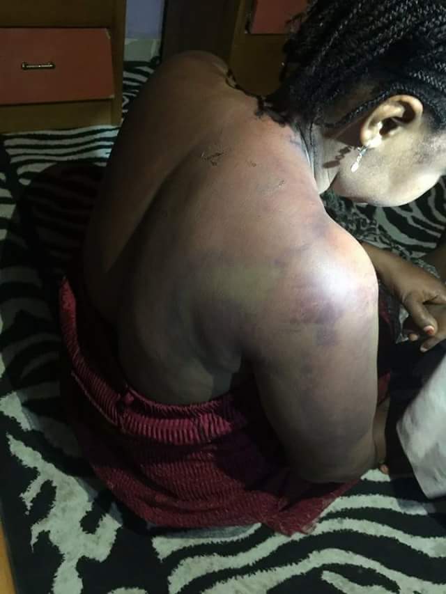 Medical Doctor Allegedly Beats Wife To Stupor In Bauchi. (Photos)