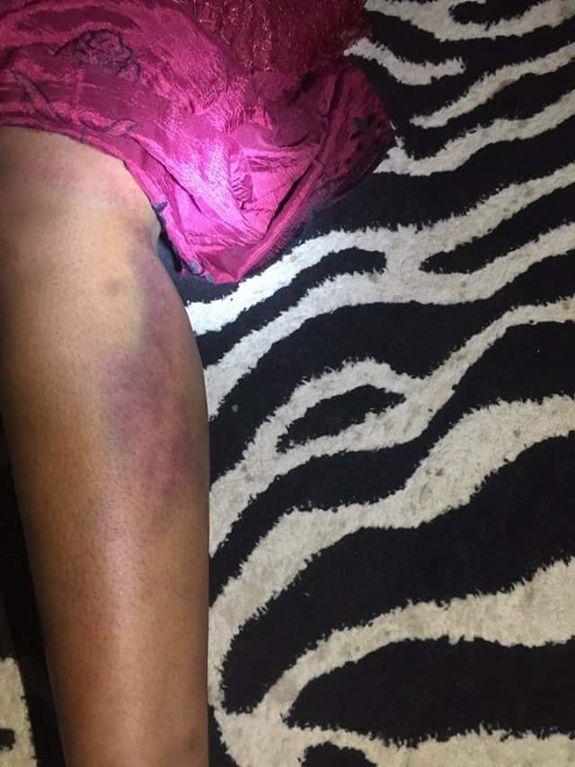 Medical Doctor Allegedly Beats Wife To Stupor In Bauchi. (Photos)