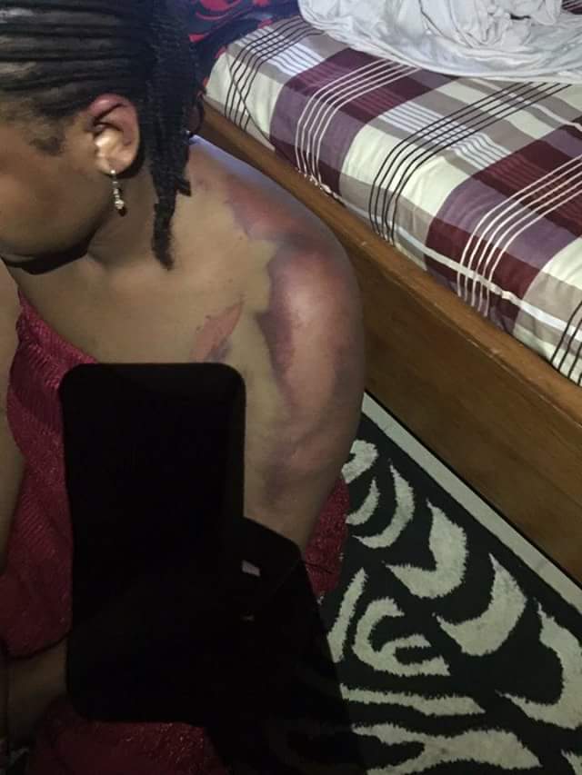 Medical Doctor Allegedly Beats Wife To Stupor In Bauchi. (Photos)