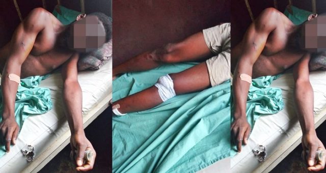 Angry father cuts off man's leg for defiling his 6 month old daughter. (Photos)