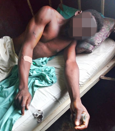 Angry father cuts off man's leg for defiling his 6 month old daughter. (Photos)