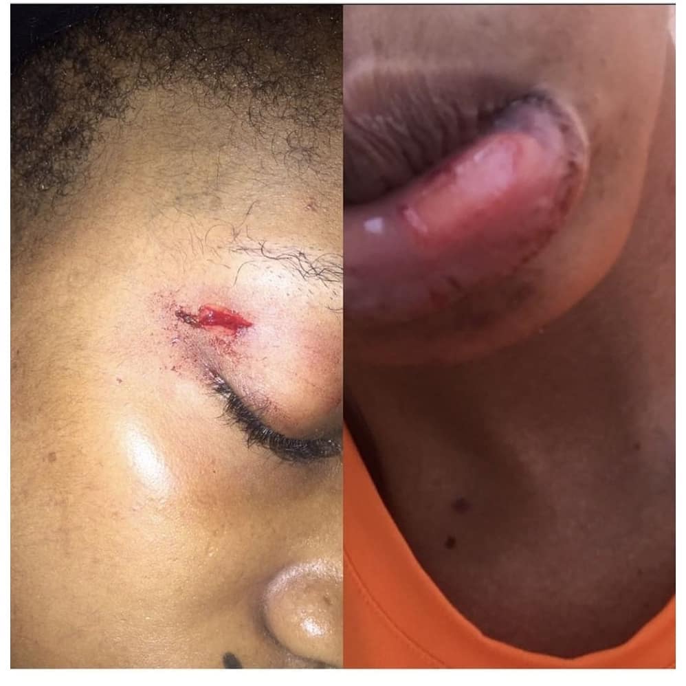 Nigerian lady calls outs her partner for assaulting her and sleeping with their househelp. (Photos)
