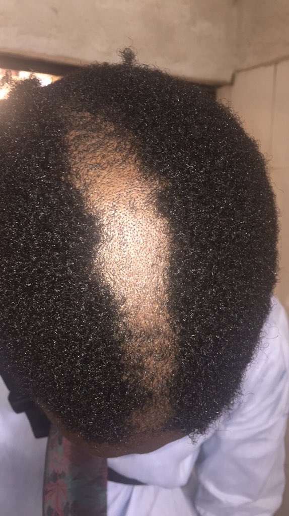 Covenant University punishes Students by Shaving Half their Hair