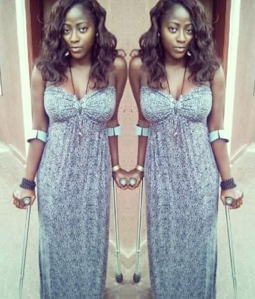 Beautiful Nigerian amputee shares her inspiring story (Photos)