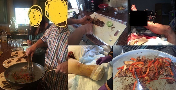 Man Serves His Amputated Foot To Friends For Dinner