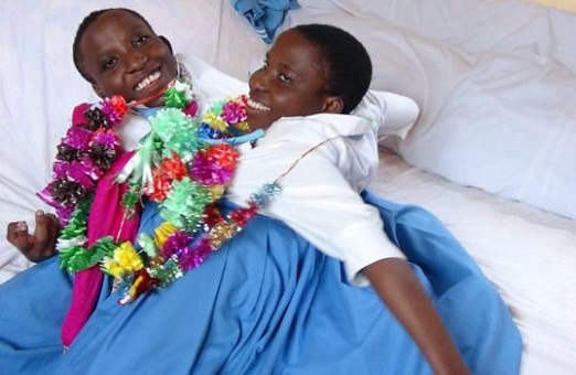 Tanzanian conjoined twins Maria and Consolata die aged 21