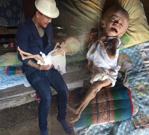 Meet The Baby Girl Born With An Oversized Head Due To Medical Condition (Photos)