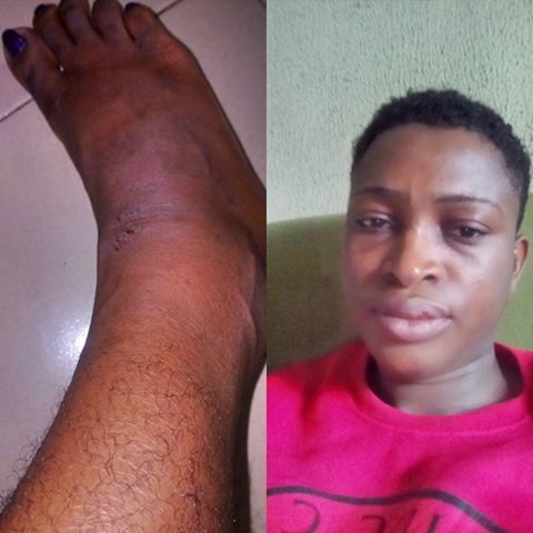 They Gave Me the Hottest Slap Ever - Lady Recounts Her Ordeal in the Hands of Policemen in Abia