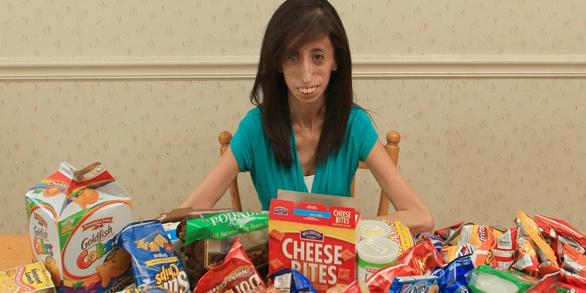 PHOTOS: The Girl Who Must Eat Every 15 Minutes To Stay Alive
