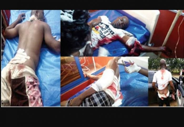 FRSC Officials Shot By Abia Speaker ' s Policemen For Stopping His Wife Set To Undergo Surgery