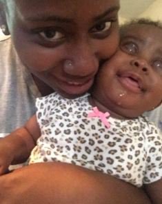 Mother Shares Touching Story Of Her Beautiful Daughter Born Without Eyes [Photos]