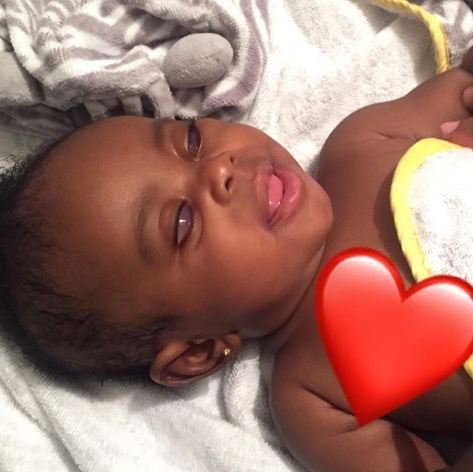 Mother Shares Touching Story Of Her Beautiful Daughter Born Without Eyes [Photos]