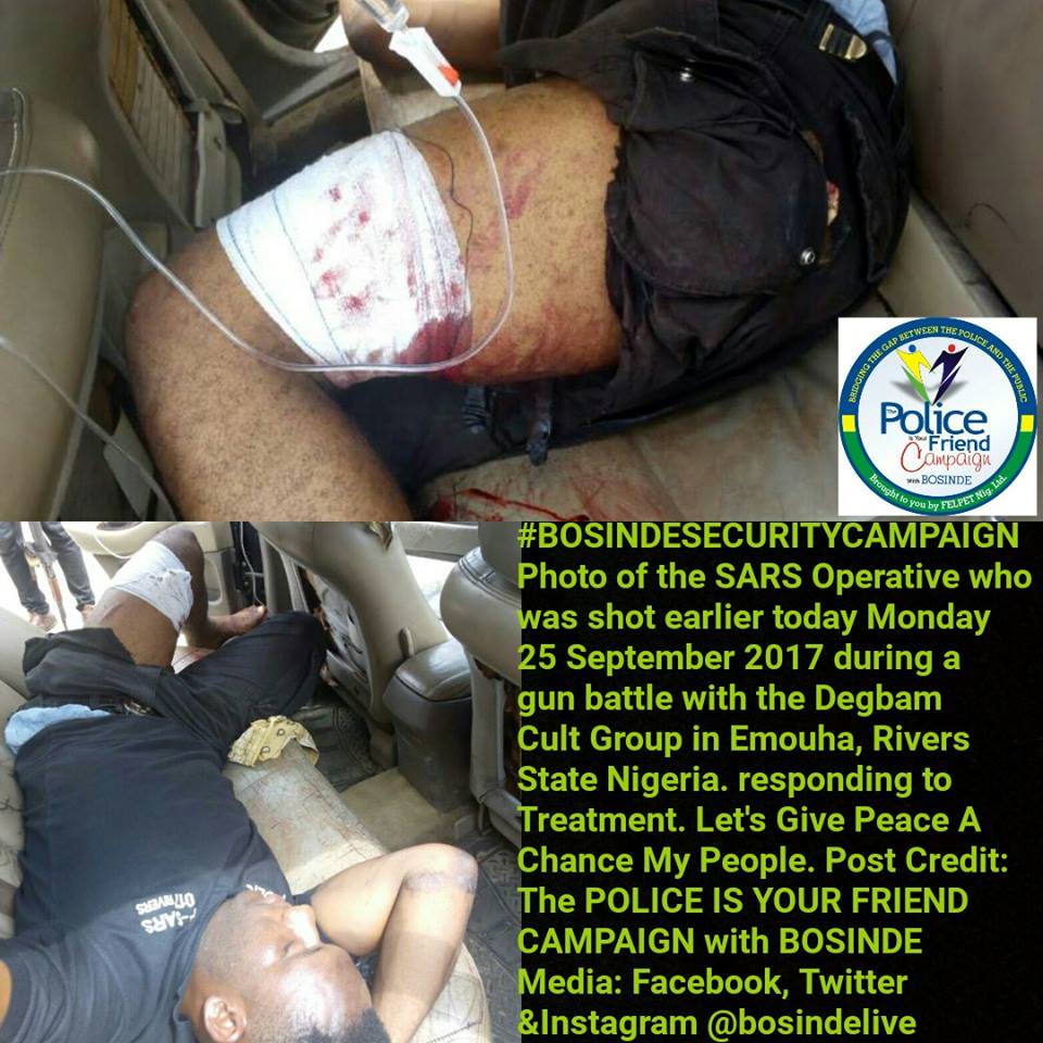SARS Operative Shot During Gun Battle With Degbam Cultists In Rivers State (Photos)