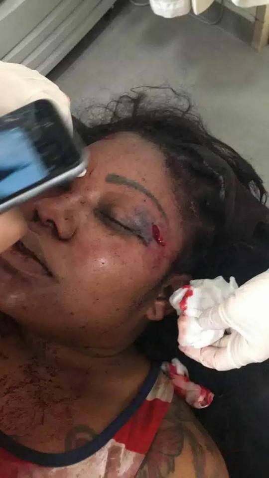 Man Brutalizes His Fiancée Few Weeks After Proposing To Her (Graphic Photos)