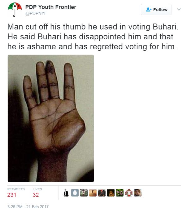 OMG: Man Cuts Off Thumb Used In Voting For President Buhari, Nigerians React (Photos)
