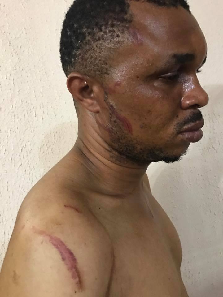 Edo SARS Officer Sent Thugs To Beat Up Guy For 'Sleeping With His Ex Wife' (Photos)