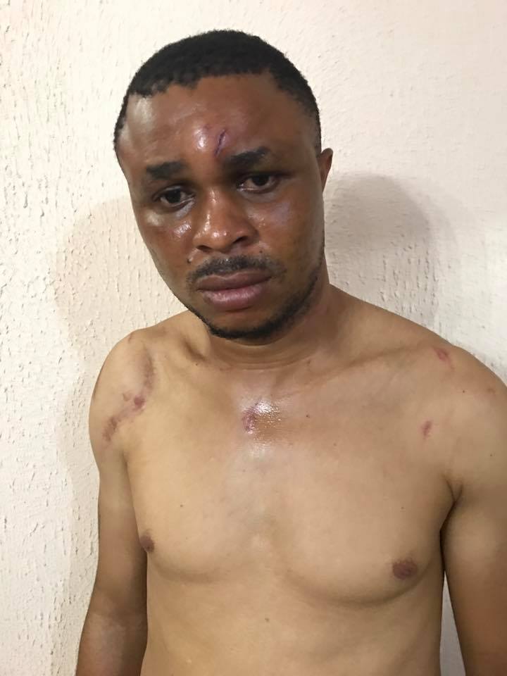 Edo SARS Officer Sent Thugs To Beat Up Guy For 'Sleeping With His Ex Wife' (Photos)