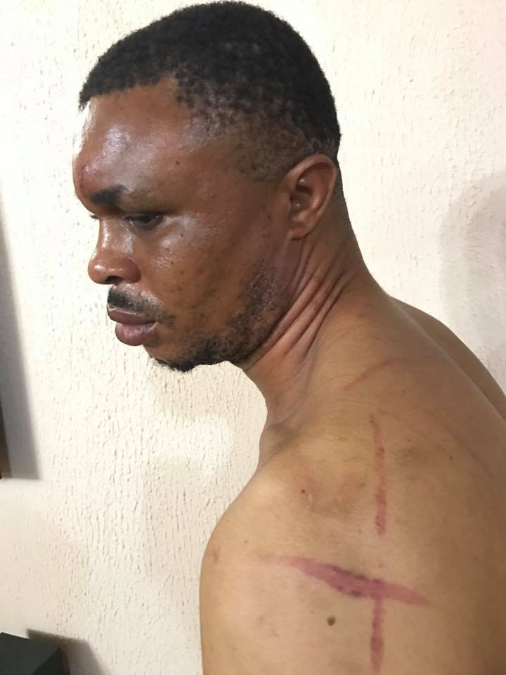 Edo SARS Officer Sent Thugs To Beat Up Guy For 'Sleeping With His Ex Wife' (Photos)