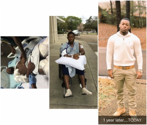 Nigerian Man Who Went To 4 Months In Jail After Surviving 22 Gunshots Shares Testimony (Photos)