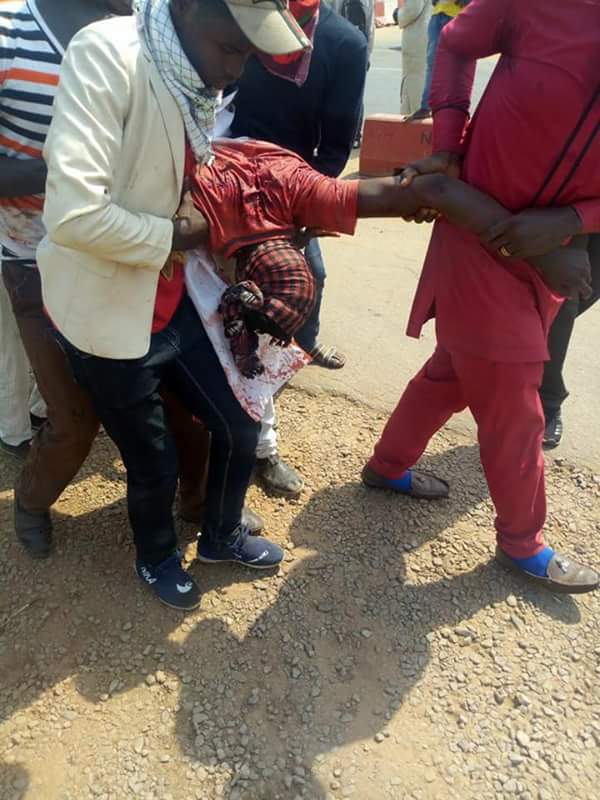 OMG! See How Police Blow Up The Brain Of A Protesting Shiite Member In Abuja (Graphic Photos)