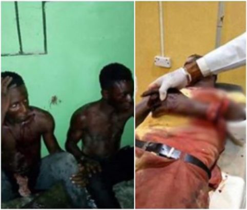 See What Robbers Did To A Corper's Hand In Bayelsa