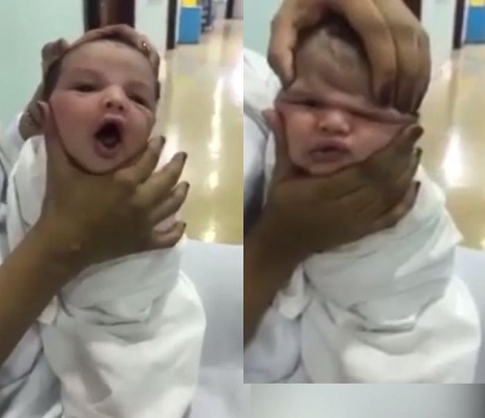 Nurses Fired For Squishing Newborn Baby's Head And Laughing While Doing It