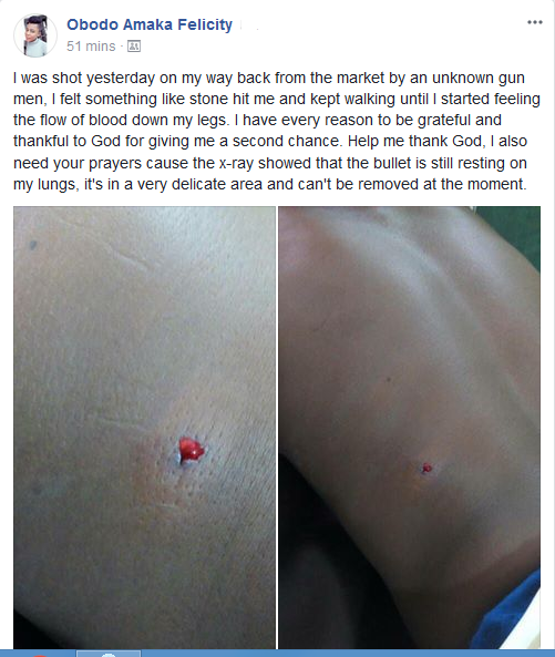 Lady Reveals How She Was Shot By Unknown Gunmen While Returning From Market (Photos)