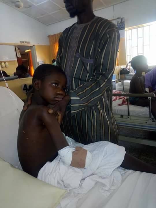 Young Boy Crippled After Being Beaten By His Teacher In Gombe (Graphic Photo)
