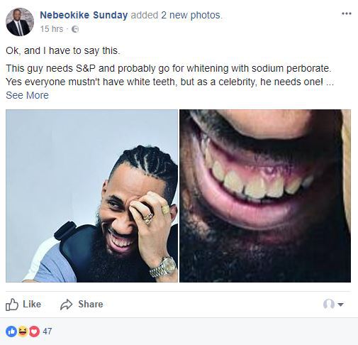 'Phyno Needs to Whiten His Teeth' - Says Nigerian Dentist