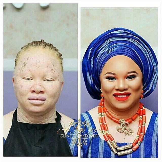 This Albino's MakeUp Transformation Is Amazing